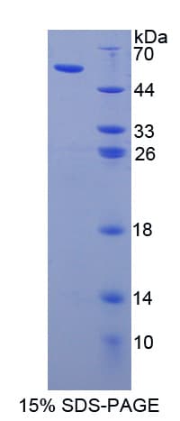 Human APOL1 / Apolipoprotein L (Recombinant His-GST-S)