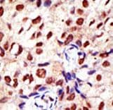 PRMT2 Antibody (aa22-53)