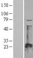 CBFB Protein (Over-Expression Lysate Myc-DDK (Flag))