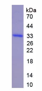 Rat IL22RA1 / IL22R Protein (Recombinant 6His, N-terminus)