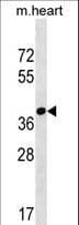 FBXO22 Antibody (aa320-347)