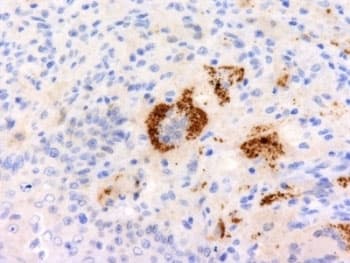 TNF Alpha Antibody (aa115-130, clone P/T2, Azide-free, BSA-free)