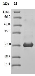 Mouse BLM Protein (Recombinant 10His, N-terminus + Myc, C-terminus)