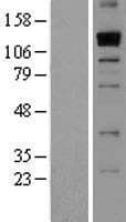 THSD1 / TMTSP Protein (Over-Expression Lysate Myc-DDK (Flag))