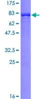 Human CALR / Calreticulin Protein (Recombinant GST)