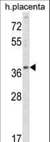 Polyclonal Rabbit anti-Human UBE2Q2 Antibody (aa168-196, WB)
