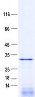 Human RNF212 Protein (Recombinant His, N-Terminal)