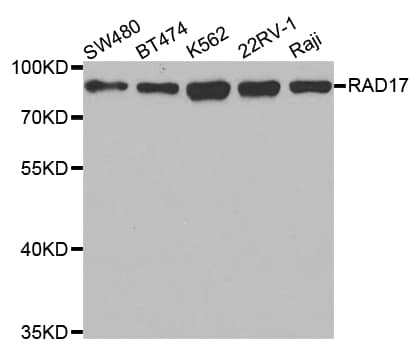 Polyclonal Rabbit anti-Human RAD17 Antibody (IHC, IF, WB)