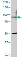 ECaC / TRPV5 Antibody (clone 6D6)
