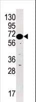 Polyclonal Rabbit anti-Human BRSK2 Antibody (aa706-736, IHC, WB)