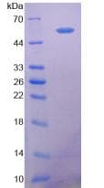 Human NT5E / eNT / CD73 Protein (Recombinant His, N-Terminal)