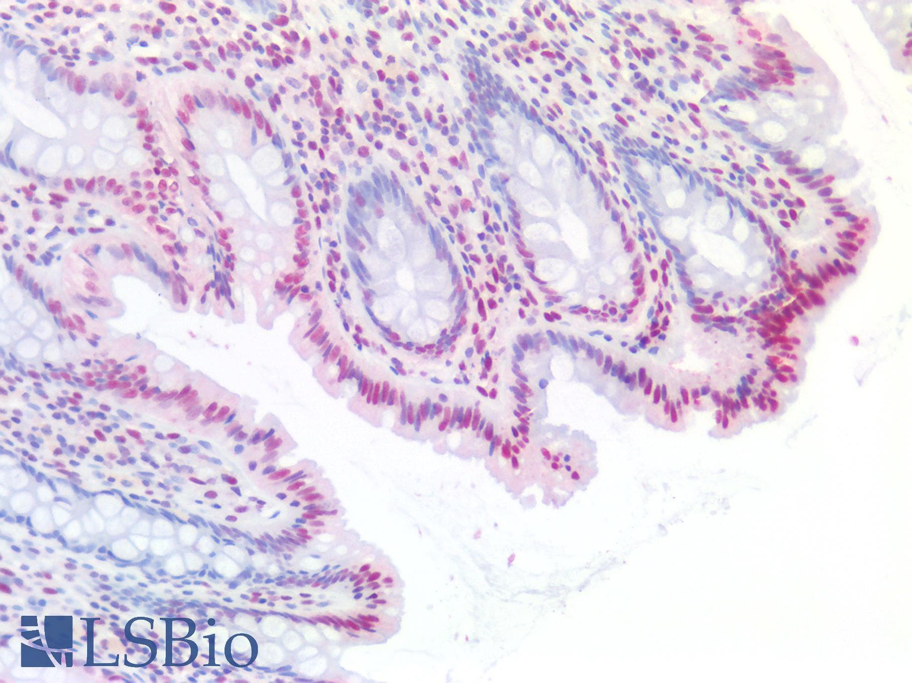 PathPlus™ EP300 / p300 Antibody (aa1572-2371, clone RW128)
