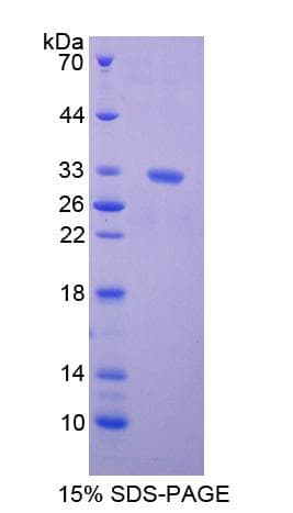 Rat Kinesin Heavy Chain / KIF5B Protein (Recombinant His-T7)