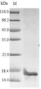 Human PIP / GCDFP-15 Protein (Recombinant 10His, N-terminus)