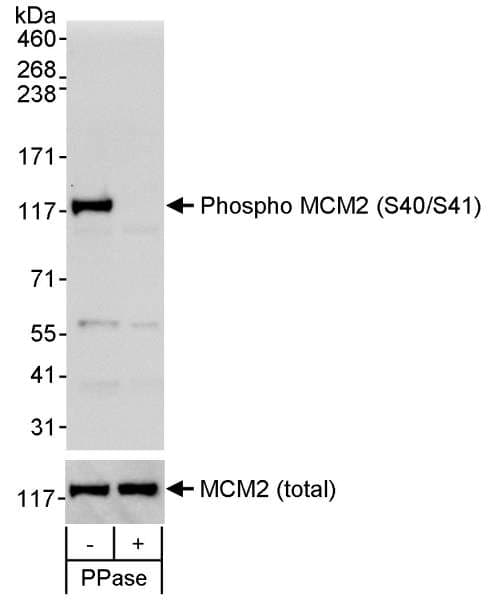 MCM2 Antibody (phospho-Ser40/41)