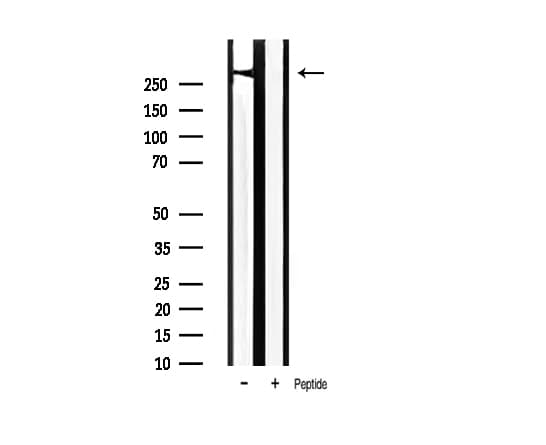 Polyclonal Rabbit anti-Human FLNA / Filamin A Antibody (phospho-Ser2152, IHC, IF, WB)