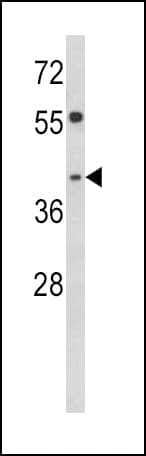 TOB2 Antibody (aa17-46)
