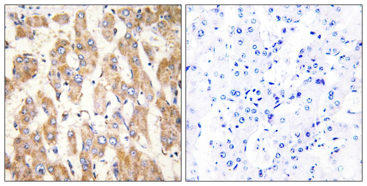 Polyclonal Rabbit anti-Human BAX Antibody (IHC, IF, WB)