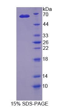 Human CRLF1 Protein (Recombinant His-GST)