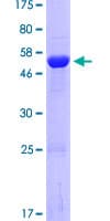 Human HAAO Protein (Recombinant GST)