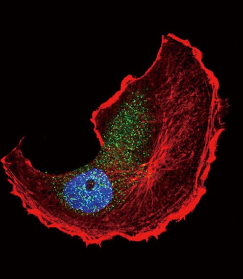Tuberin / TSC2 Antibody (phospho-Ser1798)