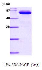 Mouse NAMPT / Visfatin Protein (Recombinant His)