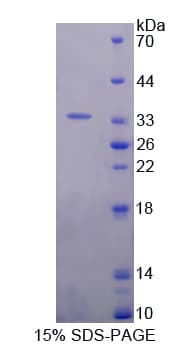 Rat IL20RA Protein (Recombinant His-T7)