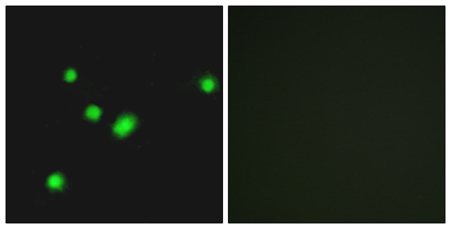 Polyclonal Rabbit anti-Human MUTYH / MYH Antibody (aa151-200, IF, WB)