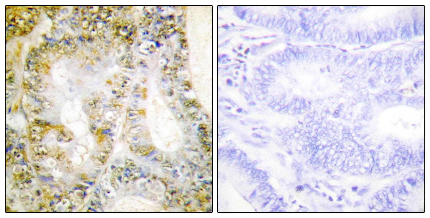 Polyclonal Rabbit anti-Human CTNNB1 / Beta Catenin Antibody (IHC, WB)