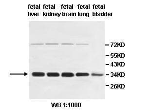 Polyclonal Rabbit anti-Human HSD17B13 Antibody (IHC, WB)