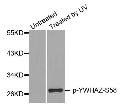 Polyclonal Rabbit anti-Human YWHAZ / 14-3-3 Zeta Antibody (phospho-Ser58, IHC, IF, WB)