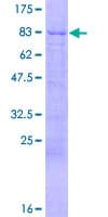 Human DKC1 / Dyskerin Protein (Recombinant GST)