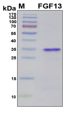 Human FGF13 Protein (Recombinant 6His, N-terminus)