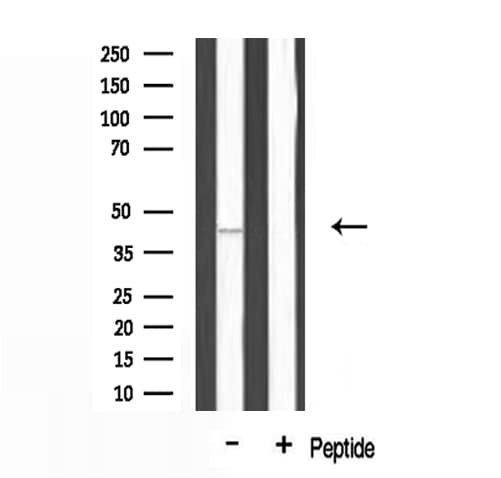 Polyclonal Rabbit anti-Human DUSP9 Antibody (IHC, IF, WB)