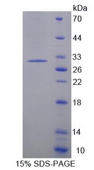 Mouse Securin / PTTG1 Protein (Recombinant His-T7)
