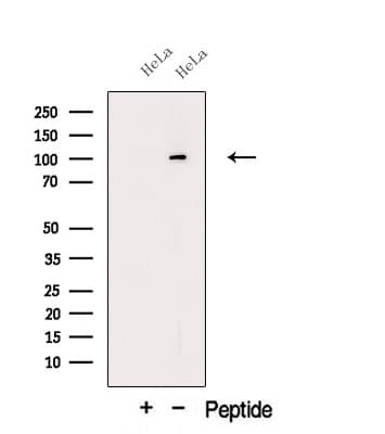 Polyclonal Rabbit anti-Human OSBPL6 Antibody (WB)