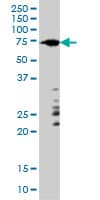 ARAF / ARAF1 / A-RAF Antibody (clone 6H6)
