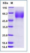 Mouse CD47 Protein (Recombinant Human IgG Fc, C-terminus)