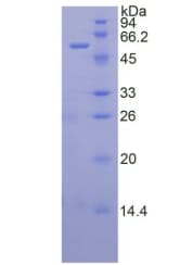 Human TFPI / LACI Protein (Recombinant His-GST)