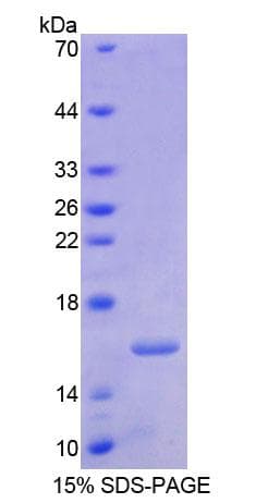 Human RARA / RAR Alpha Protein (Recombinant His-T7)