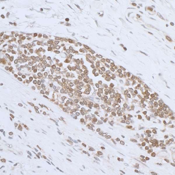 Polyclonal Rabbit anti-Human ARHGDIB / D4 GDI Antibody (aa50-100, IHC, WB)
