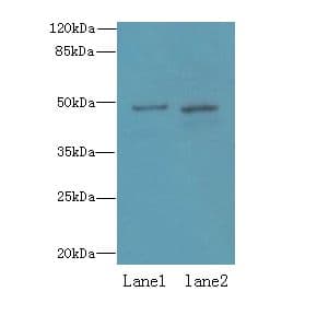 ZDHHC6 Antibody