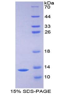 Mouse ICAM5 / ICAM-5 Protein (Recombinant His-T7)