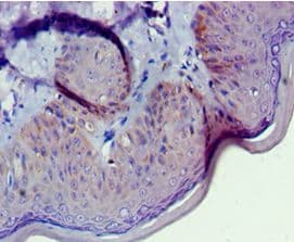 GNL3 / NS / Nucleostemin Antibody (aa1-240)