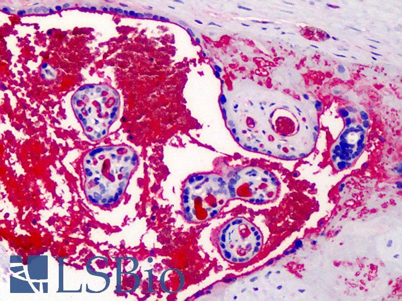 IHC-plus™ A2M / Alpha-2-Macroglobulin Antibody