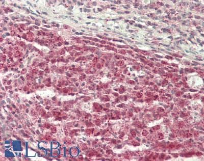 Polyclonal Rabbit anti-Human UHRF1 Antibody (aa584-633, IHC, WB)