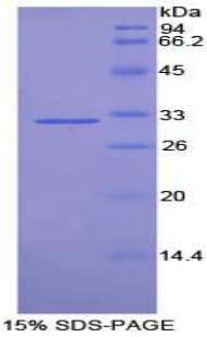 Rat TUBD1 / Tubulin Delta Protein (Recombinant His-T7)