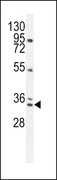 AKIP1 / BCA3 Antibody (aa54-83)