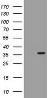 TS / Thymidylate Synthase Antibody (clone OTI1C4)