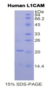 Human L1CAM Protein (Recombinant His)
